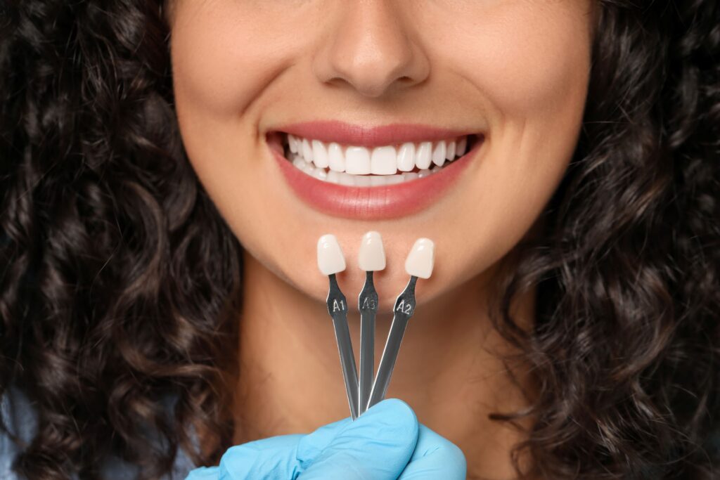 Nose-to-neck view of woman with curly hair smiling with shade guide held to teeth